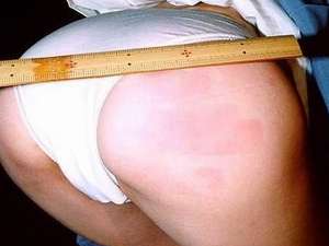 無料SM画像 折檻で赤く染まる綺麗な女尻